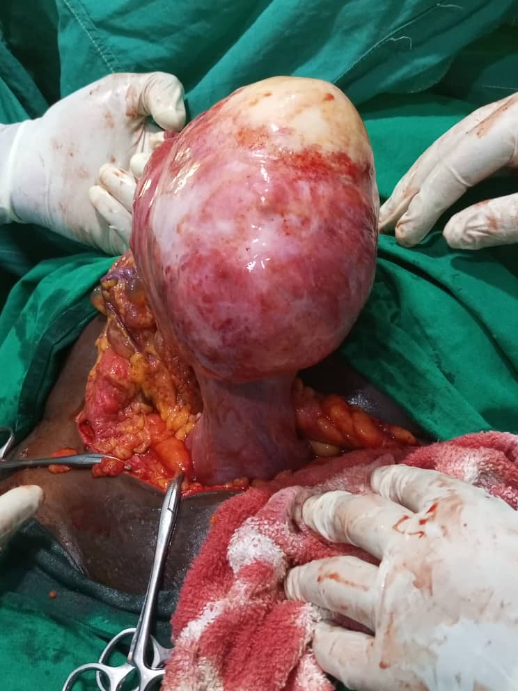 Clinical case photograph: Surgical Case 1