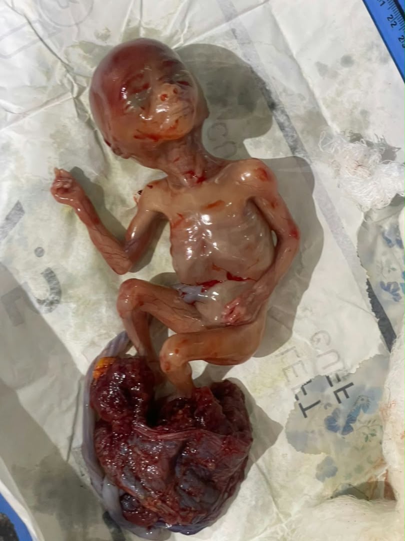Clinical case photograph: Clinical Case 7