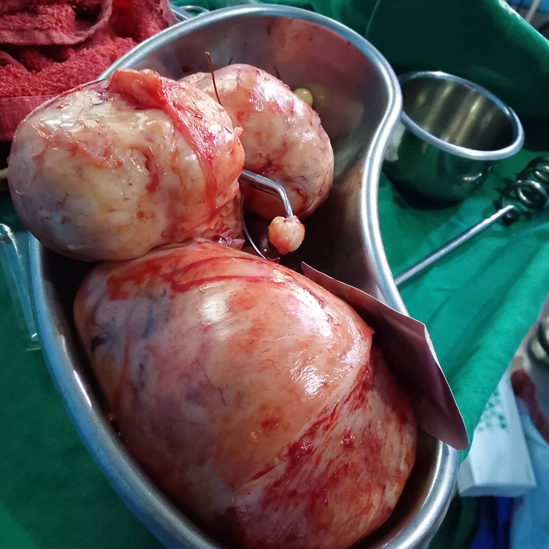 Clinical case photograph: Surgical Case 4