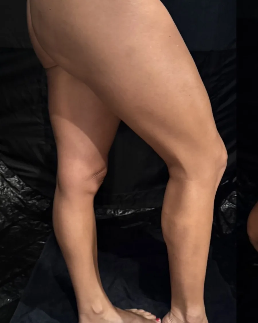 Before spray tanning: legs before session