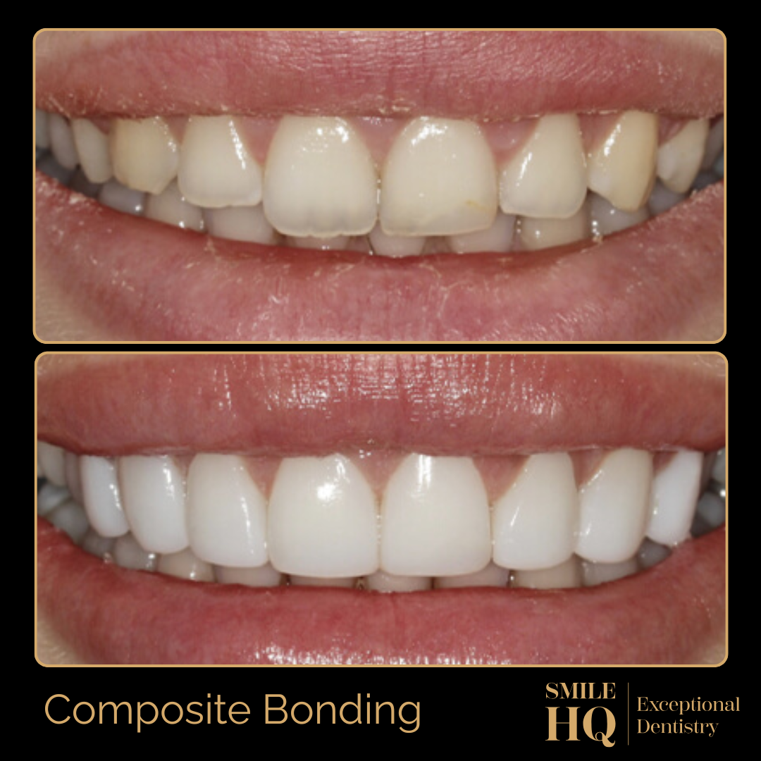 Case 1 - Smile HQ