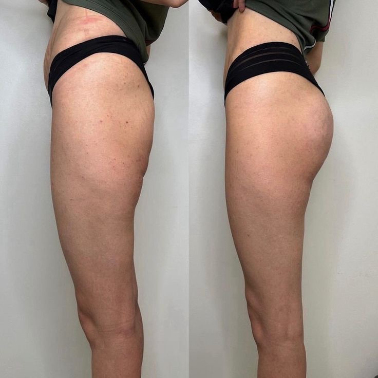Glute-Fokus: Runder, praller Po
