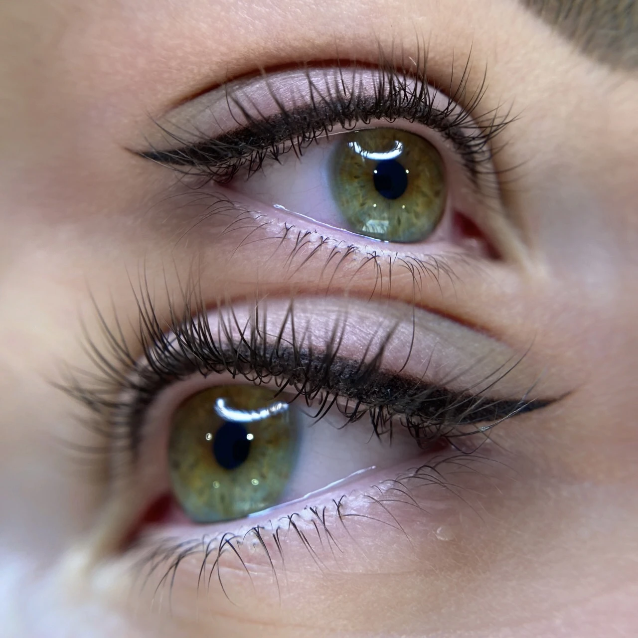 Supplied KARKIRA eyes photograph