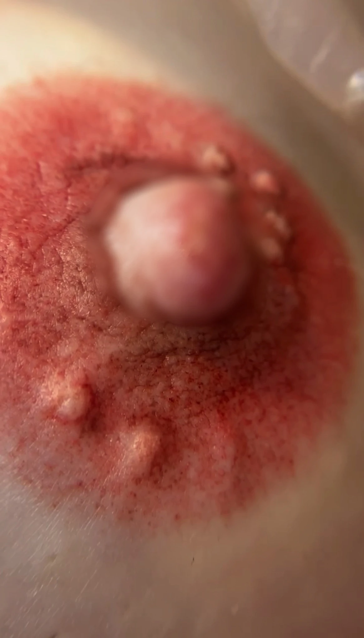 Supplied KARKIRA medical photograph
