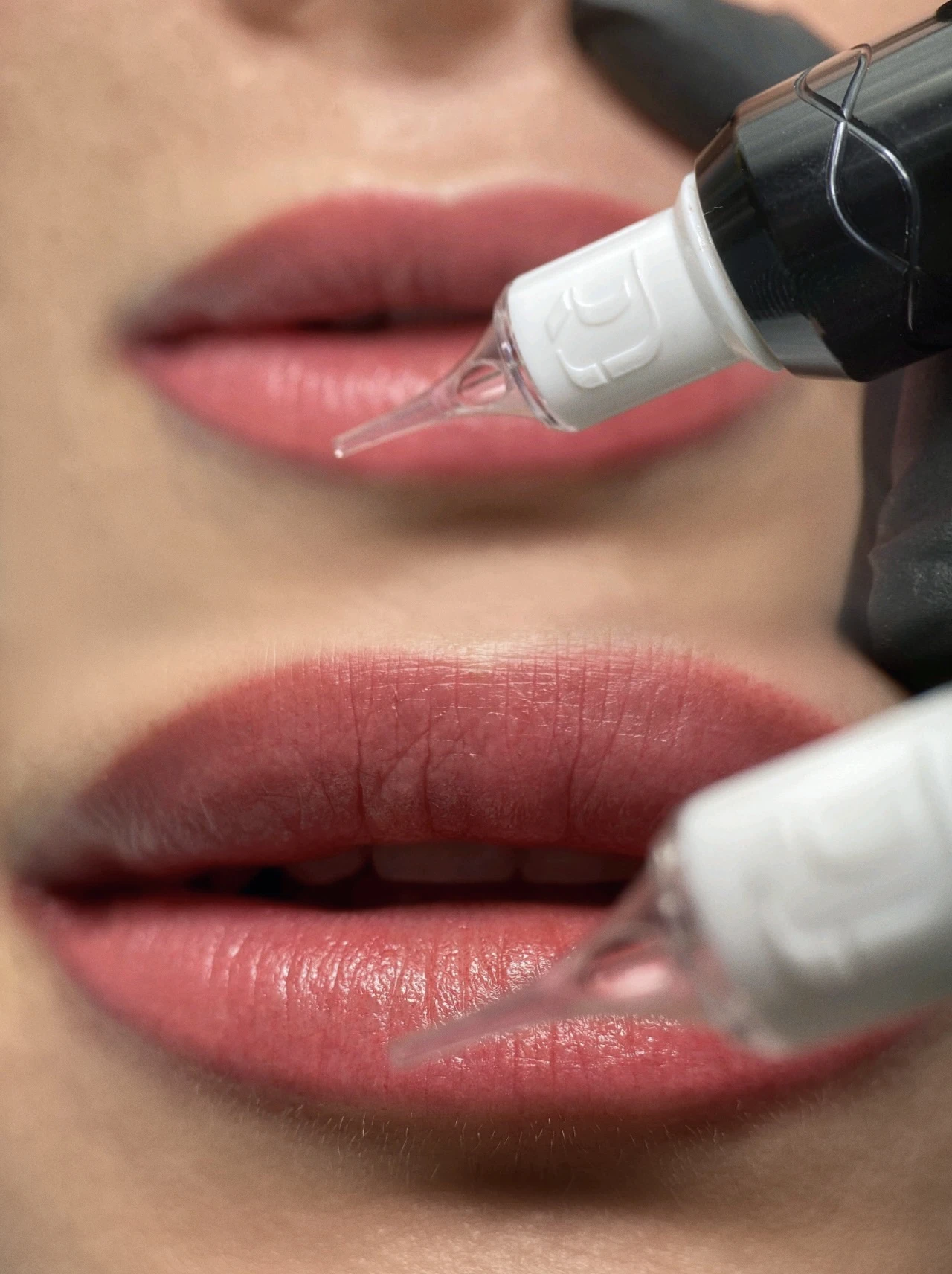 Supplied KARKIRA lips photograph