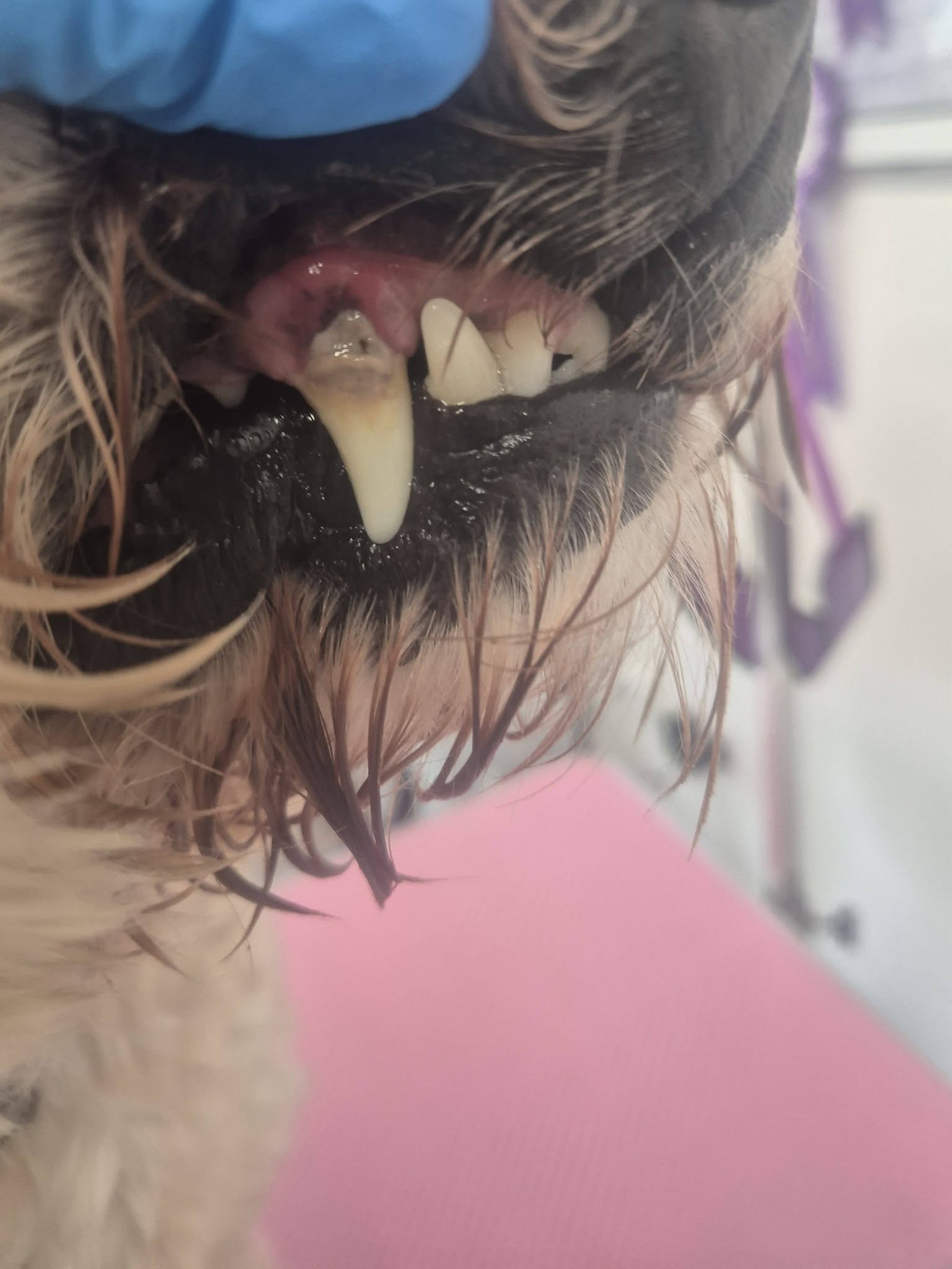Teeth before treatment with plaque buildup