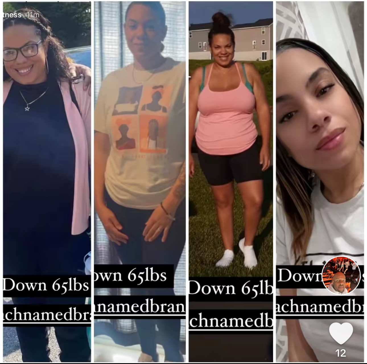 Full P5 Method Transformation - Before and After client progress